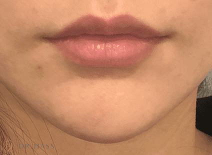 Lips