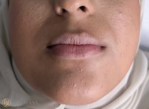 Lips