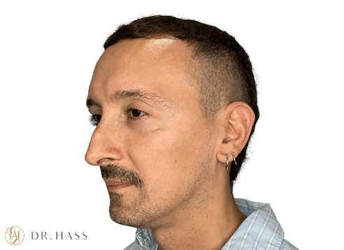 Dr-Hass-jaw