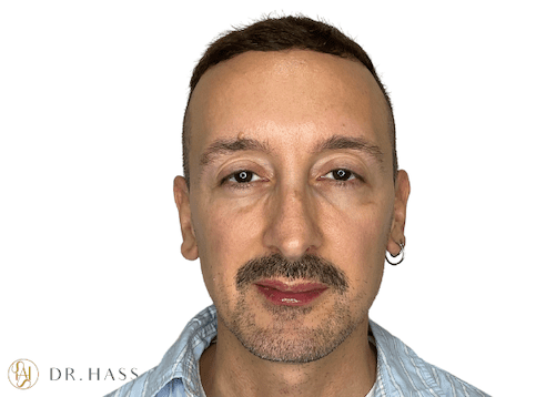 Dr Hass - Masculinization