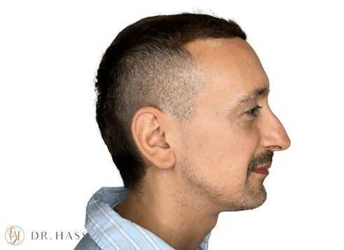 Dr Hass - Profile Balancing