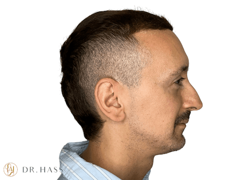 Dr Hass - Profile Balancing