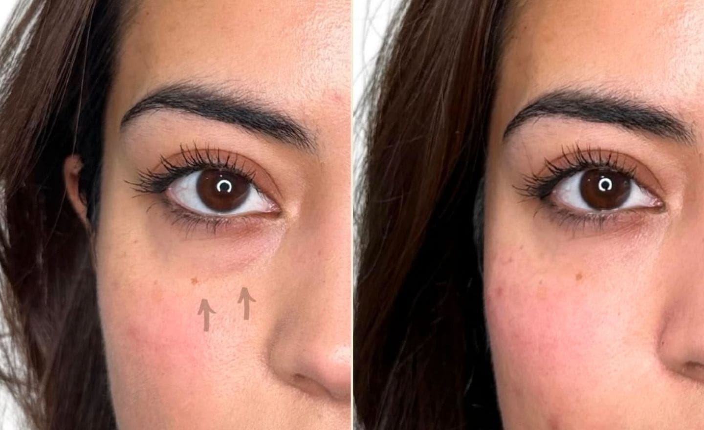 Trough Fillers Transform-before & after